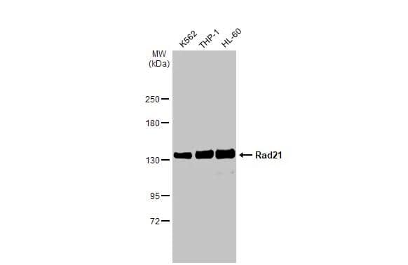 Various whole cell extracts (30 ug) were separated by 5% SDS-PAGE, and the membrane was blotted with Rad21 antibody (NBP2-20053) diluted at 1:1000. The HRP-conjugated anti-rabbit IgG antibody  was used to detect the primary antibody. 
