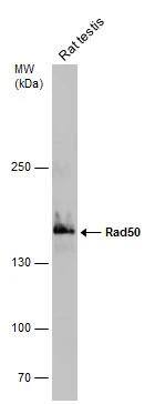 Rat tissue extract (50 ug) was separated by 5% SDS-PAGE, and the membrane was blotted with Rad50 antibody [C1C2], Internal (NBP2-20054) diluted at 1:1000. 