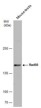 Mouse tissue extract (50 ug) was separated by 5% SDS-PAGE, and the membrane was blotted with Rad50 antibody [C1C2], Internal (NBP2-20054) diluted at 1:5000. 