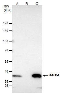 Rad51 antibody immunoprecipitates Rad51 protein in IP experiments.IP samples: Jurkat whole cell extractA. 40 ug Jurkat whole cell extractB. Control with 4 ug of preimmune Rabbit IgGC. Immunoprecipitation of Rad51 protein by 4 ug Rad51 antibody (NBP2-20058)5 % SDS-PAGEThe immunoprecipitated Rad51 protein was detected by Rad51 antibody (NBP2-20058) diluted at 1:500.[EasyBlot anti-rabbit IgG  was used as a secondary reagent] 