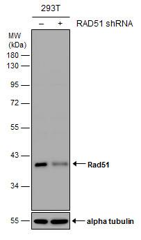 <b>Genetic Strategies Validation. </b>Non-transfected (-) and transfected (+) 293T whole cell extracts (30 ug) were separated by 10% SDS-PAGE, and the membrane was blotted with Rad51 antibody (NBP2-20058) diluted at 1:1000. 