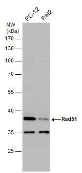 Various whole cell extracts (30 ug) were separated by 10% SDS-PAGE, and the membrane was blotted with Rad51 antibody (NBP2-20058) diluted at 1:500. 