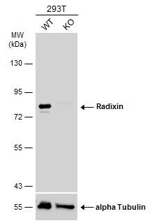 <b>Genetic Strategies Validation. </b>Western Blot: Radixin Antibody [NBP2-20063] - Wild-type (WT) and Radixin knockout (KO) 293T cell extracts (30 ug) were separated by 7.5% SDS-PAGE, and the membrane was blotted with Radixin antibody [N3C3]  diluted at 1:1000. The HRP-conjugated anti-rabbit IgG antibody  was used to detect the primary antibody.