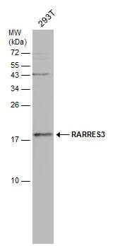 Whole cell extract (30 ug) was separated by 15% SDS-PAGE, and the membrane was blotted with RARRES3 antibody [N1C3] (NBP2-20080) diluted at 1:1000. 