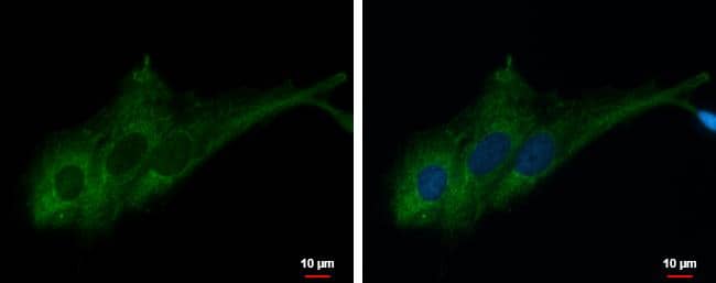 RASA3 antibody [C2C3], C-term detects RASA3 protein at cytoplasm by immunofluorescent analysis.Sample: SK-N-SH cells were fixed in 4% paraformaldehyde at RT for 15 min.Green: RASA3 protein stained by RASA3 antibody [C2C3], C-term (NBP2-20081) diluted at 1:500.Blue: Hoechst 33342 staining.Scale bar = 10 um. 