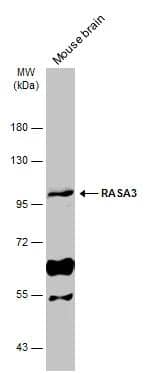 Mouse tissue extract (50 ug) was separated by 7.5% SDS-PAGE, and the membrane was blotted with RASA3 antibody [C2C3], C-term (NBP2-20081) diluted at 1:1000. The HRP-conjugated anti-rabbit IgG antibody  was used to detect the primary antibody. 