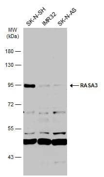 Various whole cell extracts (30 ug) were separated by 7.5% SDS-PAGE, and the membrane was blotted with RASA3 antibody [C2C3], C-term (NBP2-20081) diluted at 1:500. The HRP-conjugated anti-rabbit IgG antibody  was used to detect the primary antibody. 