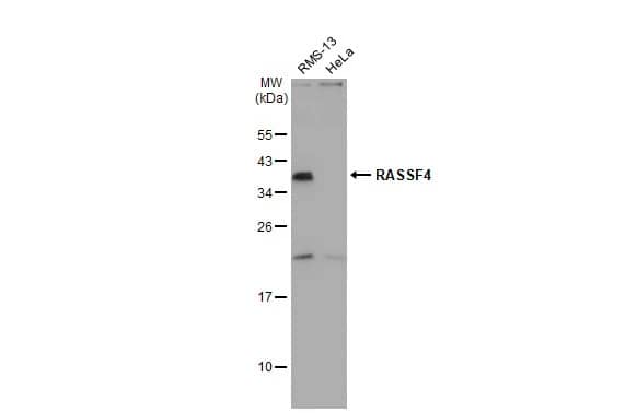 Western Blot RASSF4 Antibody