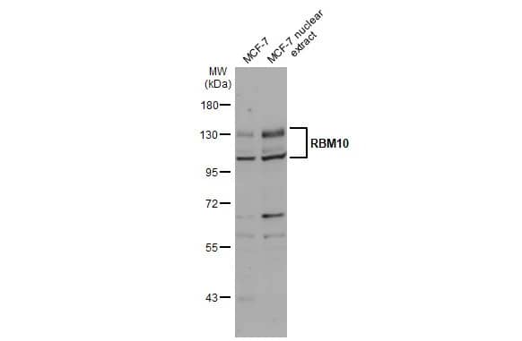 Western Blot: RBM10 Antibody [NBP2-20100] - MCF-7 whole cell and nuclear extracts (30 ug) were separated by 7.5% SDS-PAGE, and the membrane was blotted with RBM10 antibody (NBP2-20100) diluted at 1:1000. The HRP-conjugated anti-rabbit IgG antibody  was used to detect the primary antibody.