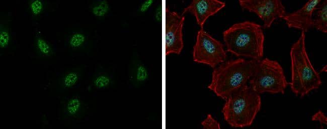 RBM26 antibody [C1C2], Internal detects RBM26 protein at nucleus by immunofluorescent analysis.Sample: HeLa cells were fixed in 4% paraformaldehyde at RT for 15 min.Green: RBM26 protein stained by RBM26 antibody [C1C2], Internal (NBP2-20105) diluted at 1:500.Red: phalloidin, a cytoskeleton marker, diluted at 1:200.Blue: Hoechst 33342 staining.Scale bar = 10 um. 