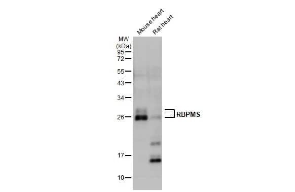 Western Blot: RBPMS Antibody [NBP2-20112] - Various tissue extracts (50 ug) were separated by 12% SDS-PAGE, and the membrane was blotted with RBPMS antibody (NBP2-20112) diluted at 1:3000. The HRP-conjugated anti-rabbit IgG antibody  was used to detect the primary antibody.