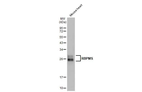 Western Blot: RBPMS Antibody [NBP2-20112] - Mouse tissue extract (50 ug) was separated by 12% SDS-PAGE, and the membrane was blotted with RBPMS antibody (NBP2-20112) diluted at 1:3000. The HRP-conjugated anti-rabbit IgG antibody  was used to detect the primary antibody.