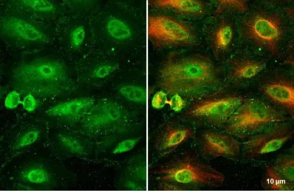 Immunocytochemistry/ Immunofluorescence: RBPMS Antibody [NBP2-20112] - RBPMS antibody detects RBPMS protein at cytoplasm and nucleus by immunofluorescent analysis.Sample: A549 cells were fixed in 4% paraformaldehyde at RT for 15 min.Green: RBPMS stained by RBPMS antibody (NBP2-20112) diluted at 1:500.Red: alpha Tubulin, a cytoskeleton marker, stained by alpha Tubulin antibody [GT114]  diluted at 1:1000.