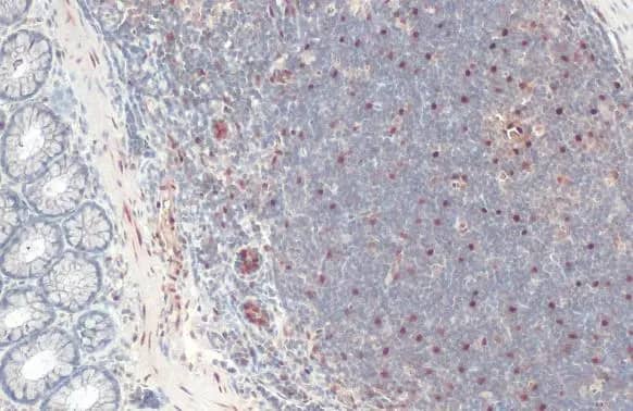 Immunohistochemistry-Paraffin: RBPMS Antibody [NBP2-20112] - RBPMS antibody detects RBPMS protein at cytoplasm and nucleus by immunohistochemical analysis.Sample: Paraffin-embedded rat colon.RBPMS stained by RBPMS antibody (NBP2-20112) diluted at 1:500.Antigen Retrieval: Citrate buffer, pH 6.0, 15 min