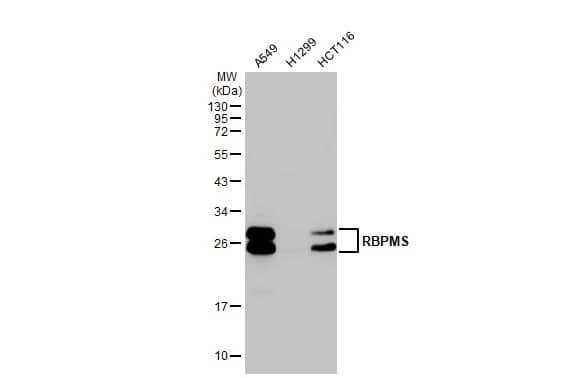 Western Blot: RBPMS Antibody [NBP2-20112] - Various whole cell extracts (30 ug) were separated by 12% SDS-PAGE, and the membrane was blotted with RBPMS antibody (NBP2-20112) diluted at 1:500. The HRP-conjugated anti-rabbit IgG antibody  was used to detect the primary antibody.