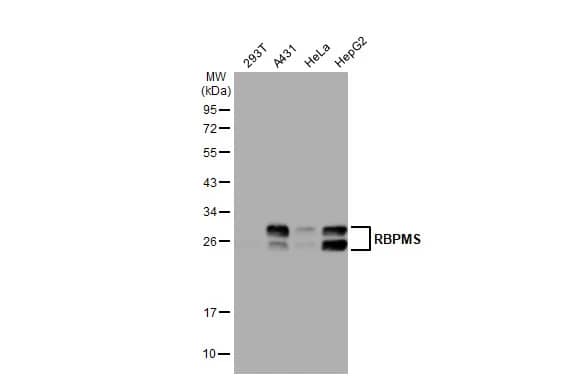 Western Blot: RBPMS Antibody [NBP2-20112] - Various whole cell extracts (30 ug) were separated by 12% SDS-PAGE, and the membrane was blotted with RBPMS antibody (NBP2-20112) diluted at 1:500. The HRP-conjugated anti-rabbit IgG antibody  was used to detect the primary antibody.