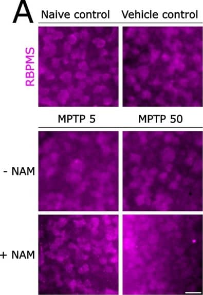 Nicotinamide provides a robust, long-term retinal ganglion cell neuroprotection following intravitreal MPTP administration. A Retinal ganglion cells were labelled in whole-mounted retina with anti-RBPMS (magenta) in Thy1-CFP mice. B There was no significant difference in RBPMS+ retinal ganglion cell density between the vehicle control group and the groups treated with NAM prior to injection of 5 mg/mL MPTP or 50 mg/mL MPTP, supporting the protection of retinal ganglion cells by NAM. Scale bar = 20 um in A Image collected and cropped by CiteAb from the following open publication (//pubmed.ncbi.nlm.nih.gov/38773545), licensed under a CC-BY license. Not internally tested by Novus Biologicals.