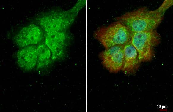 RBPMS antibody detects RBPMS protein at cytoplasm and nucleus by immunofluorescent analysis.Sample: A431 cells were fixed in 4% paraformaldehyde at RT for 15 min.Green: RBPMS stained by RBPMS antibody (NBP2-20112) diluted at 1:500.Red: alpha Tubulin, a cytoskeleton marker, stained by alpha Tubulin antibody [GT114]  diluted at 1:1000.Blue: Fluoroshield with DAPI . 