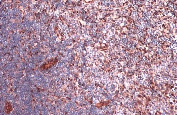 RBPMS antibody detects RBPMS protein at cytoplasm and nucleus by immunohistochemical analysis.Sample: Paraffin-embedded rat lymph node.RBPMS stained by RBPMS antibody (NBP2-20112) diluted at 1:2000.Antigen Retrieval: Citrate buffer, pH 6.0, 15 min 