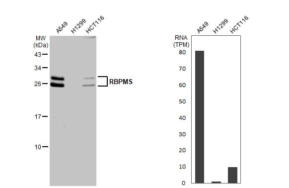Various whole cell extracts (30 ug) were separated by 12% SDS-PAGE, and the membrane was blotted with RBPMS antibody (NBP2-20112) diluted at 1:500. The HRP-conjugated anti-rabbit IgG antibody  was used to detect the primary antibody. 