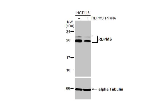 <b>Genetic Strategies Validation. </b>Non-transfected (-) and transfected (+) HCT-116 whole cell extract were separated by 12% SDS-PAGE, and the membrane was blotted with RBPMS antibody (NBP2-20112) diluted at 1:500. The HRP-conjugated anti-rabbit IgG antibody  was used to detect the primary antibody. 
