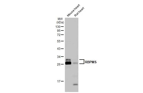 Various tissue extracts (50 ug) were separated by 12% SDS-PAGE, and the membrane was blotted with RBPMS antibody (NBP2-20112) diluted at 1:3000. The HRP-conjugated anti-rabbit IgG antibody  was used to detect the primary antibody. 