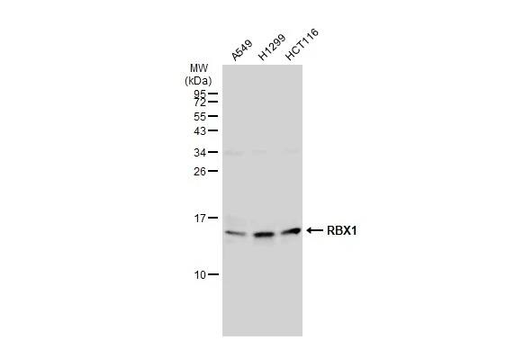 Western Blot: RBX1 Antibody [NBP2-20113] - Various whole cell extracts (30 ug) were separated by 15% SDS-PAGE, and the membrane was blotted with RBX1 antibody (NBP2-20113) diluted at 1:500. The HRP-conjugated anti-rabbit IgG antibody  was used to detect the primary antibody.