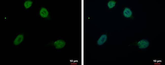 RED antibody detects RED protein at nucleus by immunofluorescent analysis.Sample: A549 cells were fixed in 4% paraformaldehyde at RT for 15 min.Green: RED protein stained by RED antibody (NBP2-20120) diluted at 1:500.Blue: Hoechst 33342 staining.Scale bar = 10 um. 
