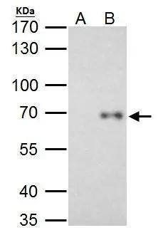 RelB antibody immunoprecipitates RelB protein in IP experiments. IP Sample: HeLa whole cell lysate/extract A. Control with 2 ug of preimmune rabbit IgG B. Immunoprecipitation of RelB protein by 2 ug of RelB antibody (NBP2-20123) 7.5% SDS-PAGE The immunoprecipitated RelB protein was detected by RelB antibody (NBP2-20123) diluted at 1:1000. EasyBlot anti-rabbit IgG  was used as a secondary reagent. 