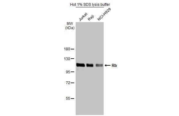 Western Blot: RB1 Antibody [NBP2-20127] - Various whole cell extracts (30 ug) were separated by 7.5% SDS-PAGE, and the membrane was blotted with RB1 antibody (NBP2-20127) diluted at 1:3000. The HRP-conjugated anti-rabbit IgG antibody  was used to detect the primary antibody.