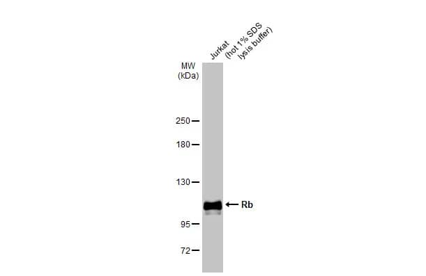 Western Blot: RB1 Antibody [NBP2-20127] - Whole cell extract (30 ug) was separated by 5% SDS-PAGE, and the membrane was blotted with RB1 antibody (NBP2-20127) diluted at 1:3000. The HRP-conjugated anti-rabbit IgG antibody  was used to detect the primary antibody.