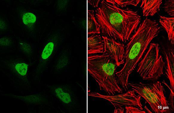 Rb antibody detects Rb protein at nucleus by immunofluorescent analysis.Sample: HeLa cells were fixed in 4% paraformaldehyde at RT for 15 min.Green: Rb stained by Rb antibody (NBP2-20127) diluted at 1:500.Red: phalloidin, a cytoskeleton marker, diluted at 1:200.Scale bar= 10 um. 