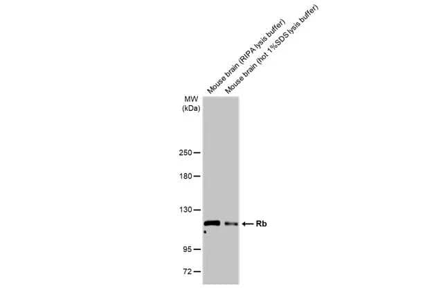 Mouse tissue extracts (50 ug) were separated by 5% SDS-PAGE, and the membrane was blotted with Rb antibody (NBP2-20127) diluted at 1:10000. The HRP-conjugated anti-rabbit IgG antibody  was used to detect the primary antibody, and the signal was developed with Trident ECL plus-Enhanced. 