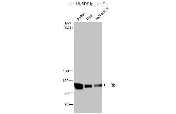 Various whole cell extracts (30 ug) were separated by 7.5% SDS-PAGE, and the membrane was blotted with Rb antibody (NBP2-20127) diluted at 1:3000. The HRP-conjugated anti-rabbit IgG antibody  was used to detect the primary antibody. 