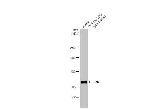 Whole cell extract (30 ug) was separated by 5% SDS-PAGE, and the membrane was blotted with Rb antibody (NBP2-20127) diluted at 1:3000. The HRP-conjugated anti-rabbit IgG antibody  was used to detect the primary antibody. 