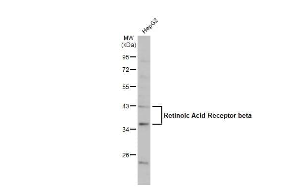 Whole cell extract (30 ug) was separated by 10% SDS-PAGE, and the membrane was blotted with Retinoic Acid Receptor beta antibody (NBP2-20129) diluted at 1:1000. The HRP-conjugated anti-rabbit IgG antibody  was used to detect the primary antibody, and the signal was developed with Trident ECL plus-Enhanced. 