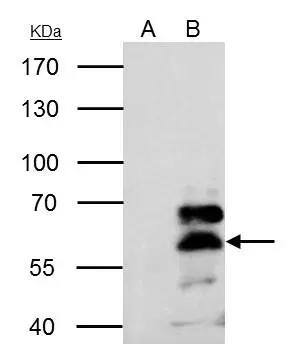 Retinoid X Receptor alpha antibody immunoprecipitates RXRA protein in IP experiments.IP samples: MCF-7 whole cell extractA. Control with 4 ug of preimmune Rabbit IgGB. Immunoprecipitation of RXRA protein by 4 ug Retinoid X Receptor alpha antibody (NBP2-20130)7.5 % SDS-PAGEThe immunoprecipitated RXRA protein was detected by Retinoid X Receptor alpha antibody (NBP2-20130) diluted at 1:500.[EasyBlot anti-rabbit IgG  was used as a secondary reagent] 