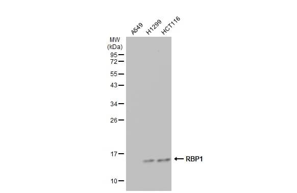 Western Blot: Retinol Binding Protein RBP Antibody [NBP2-20132] - Various whole cell extracts (30 ug) were separated by 12% SDS-PAGE, and the membrane was blotted with Retinol Binding Protein RBP antibody (NBP2-20132) diluted at 1:5000. The HRP-conjugated anti-rabbit IgG antibody  was used to detect the primary antibody.