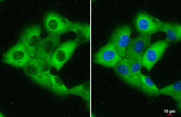 Western Blot: Retinol Binding Protein RBP Antibody [NBP2-20132] - Elevation of retinal tissue induction of visual cycle enzymes stimulated by retinoic acid 6 (STRA6, C) in chrysin-treated mice. The db/db mice were orally supplemented with 10 mg/kg of chrysin daily for 10 weeks. The db/m mice were introduced as control animals. Mouse retinal tissue extracts were subject to Western blot analysis with a primary antibody against each target protein of LRAT, RDH5, cellular retinol binding protein (CRBP), CRALBP, IRBP, or STRA6. beta-actin protein was used as an internal control. Bar graphs (mean +- SEM, n = nine independent experiments) in the bottom or right panels represent densitometric results of upper blot bands. * Values in bar graphs indicate a significant difference at pSample: H1299 cells were fixed in 4% paraformaldehyde at RT for 15 min.Green: Retinol Binding Protein RBP stained by Retinol Binding Protein RBP antibody (NBP2-20132) diluted at 1:500.Blue: Fluoroshield with DAPI .Scale bar= 10 um.