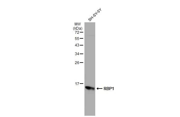 Western Blot: Retinol Binding Protein RBP Antibody [NBP2-20132] - Whole cell extract (30 ug) was separated by 12% SDS-PAGE, and the membrane was blotted with Retinol Binding Protein RBP antibody (NBP2-20132) diluted at 1:5000. The HRP-conjugated anti-rabbit IgG antibody  was used to detect the primary antibody.