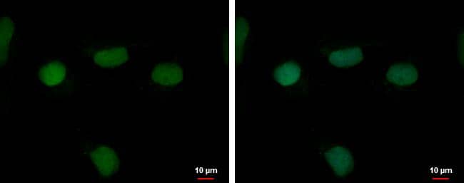 RFPL4B antibody [N2C3] detects RFPL4B protein at nucleus by immunofluorescent analysis.Sample: NT2D1 cells were fixed in 4% paraformaldehyde at RT for 15 min.Green: RFPL4B protein stained by RFPL4B antibody [N2C3] (NBP2-20140) diluted at 1:500.Blue: Hoechst 33342 staining. 