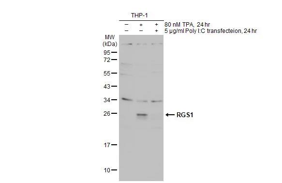 Western Blot: RGS1 Antibody [NBP2-20146] - Untreated (-) and treated (+) THP-1 whole cell extract (30 ug) were separated by 12% SDS-PAGE, and the membrane was blotted with RGS1 antibody (NBP2-20146) diluted at 1:1000. The HRP-conjugated anti-rabbit IgG antibody  was used to detect the primary antibody.