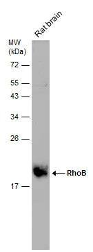 Rat tissue extract (50 ug) was separated by 12% SDS-PAGE, and the membrane was blotted with RhoB antibody (NBP2-20154) diluted at 1:1000. 
