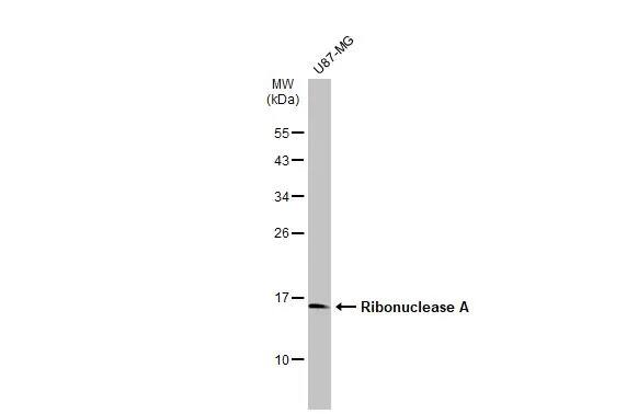 Western Blot: Ribonuclease A Antibody [NBP2-20160] - Whole cell extract (30 ug) was separated by 12% SDS-PAGE, and the membrane was blotted with Ribonuclease A antibody (NBP2-20160) diluted at 1:1000. The HRP-conjugated anti-rabbit IgG antibody  was used to detect the primary antibody.