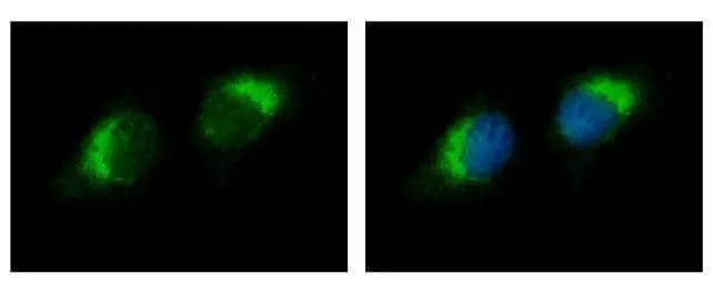 Ribonuclease A antibody detects RNASE1 protein at cytoplasm by immunofluorescent analysis. Sample: HeLa cells were fixed in 4% paraformaldehyde at RT for 15 min.Green: RNASE1 protein stained by Ribonuclease A antibody (NBP2-20160) diluted at 1:500.Blue: Hoechst 33342 staining. 