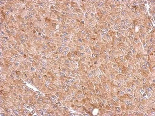 Immunohistochemistry RIOK3 Antibody