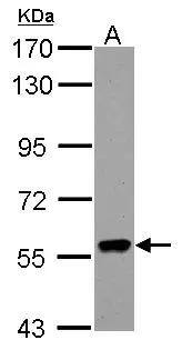 Sample (30 ug of whole cell lysate)  A: HL-60  7.5% SDS PAGE  NBP2-20167 diluted at 1:1000  