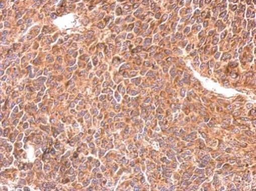 Immunohistochemistry: Rit1 Antibody [NBP2-20169] - Rit1 antibody detects Rit1 protein at cytosol on BT483 xenograft by immunohistochemical analysis. Sample: Paraffin-embedded BT4838 xenograft. Rit1 antibody (NBP2-20169) dilution: 1:500.Antigen Retrieval: Trilogy™ (EDTA based, pH 8.0) buffer, 15min