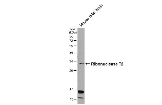 Mouse tissue extracts (50 ug) was separated by 12% SDS-PAGE, and the membrane was blotted with Ribonuclease T2 antibody [N1C3] (NBP2-20173) diluted at 1:500. The HRP-conjugated anti-rabbit IgG antibody  was used to detect the primary antibody. 