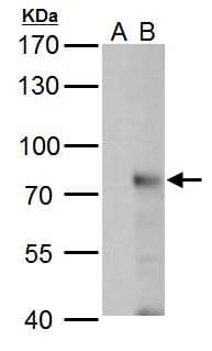 RNF168 antibody detects RNF168 protein by western blot analysis.A. 30 ug 293T whole cell lysate/extract B. 30 ug whole cell lysate/extract of human RNF168-transfected 293T cells7.5 % SDS-PAGERNF168 antibody (NBP2-20178) dilution: 1:5000 